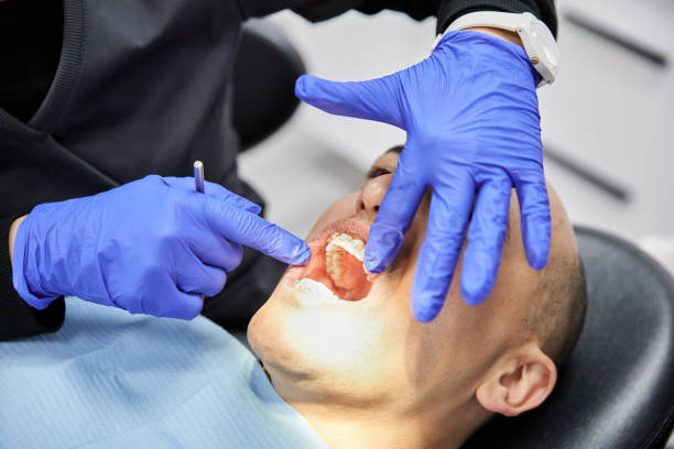 Best Emergency Treatment for Dental Infections or Abscesses in Velda City, MO